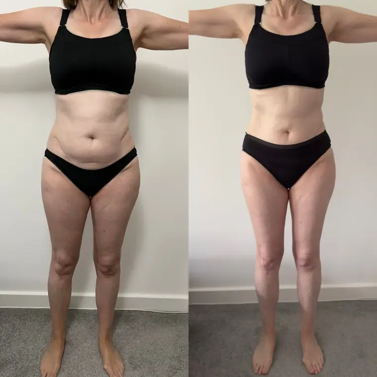 Julia R. — Hōm member progress photo