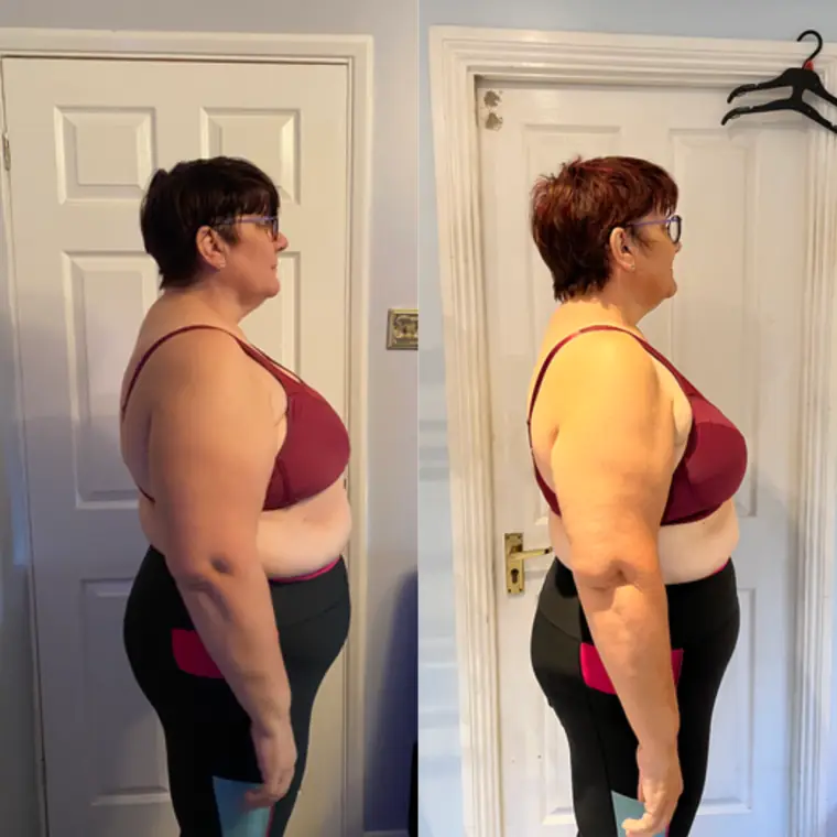 Lorraine B. — Hōm member progress photo