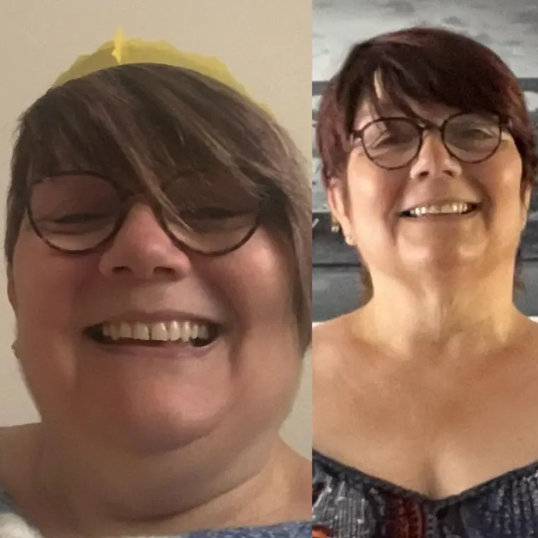 Lorraine B. — Hōm member progress photo